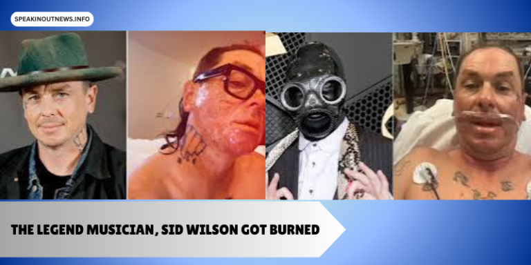 Slipknot’s Sid Wilson In Recovery After Being Hospitalized For Severe Burns In Bonfire Accident