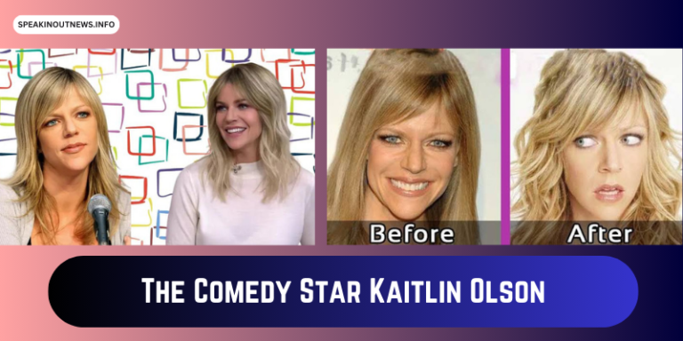 Fans Speculating About Kaitlin Olson’s Plastic Surgery Rumors. The Unseen Truth Of Olson’s  Facial Changes